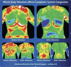 whole body vibration
