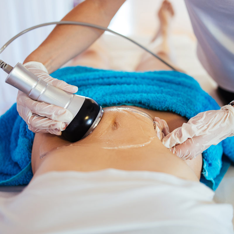 Ultrasonic Cavitation
