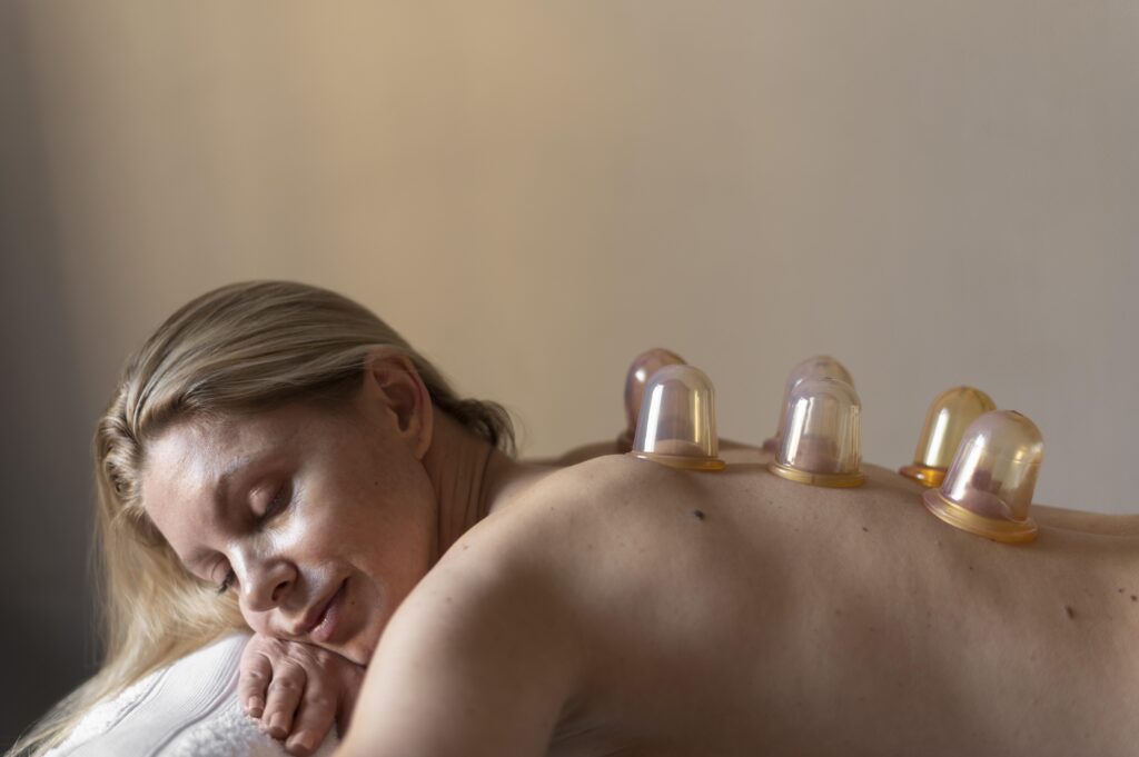 cupping